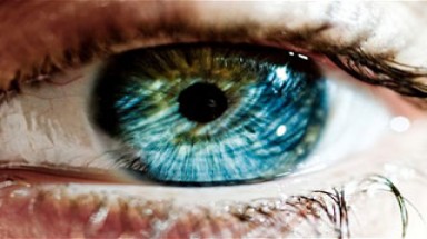 Biến mắt nâu thành xanh bằng laser